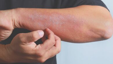 انتشار الأمراض الفطرية: تصاعد التهديد يمتد عبر العالم