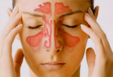 إرشادات مفيدة للأشخاص الذين يعانون من مشاكل في الجيوب الأنفية