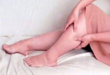 الوزن في منطقة الفخذين: إشارة لاحتمالية تطوّر الوذمة الشحميةالوزن في منطقة الفخذين: إشارة لاحتمالية تطوّر الوذمة الشحمية