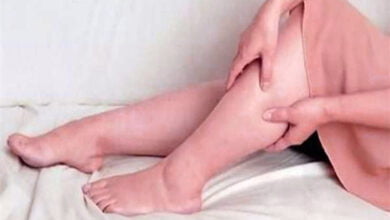 الوزن في منطقة الفخذين: إشارة لاحتمالية تطوّر الوذمة الشحميةالوزن في منطقة الفخذين: إشارة لاحتمالية تطوّر الوذمة الشحمية