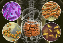 بكتيريا الأمعاء قد تسبب السمنة