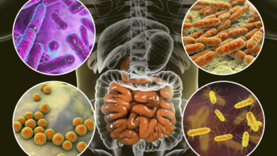 بكتيريا الأمعاء قد تسبب السمنة