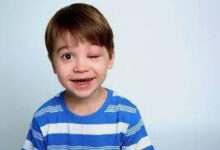 ‫ما هي الوذمة الوعائية الوراثية؟