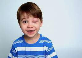 ‫ما هي الوذمة الوعائية الوراثية؟