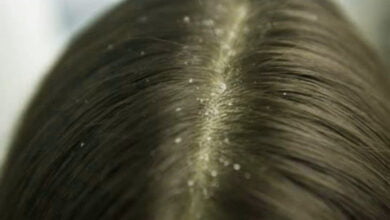 القضاء على قمل الرأس نهائيا