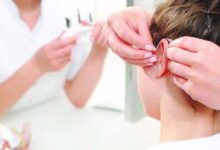 علاج جيني يعيد السمع لأطفال