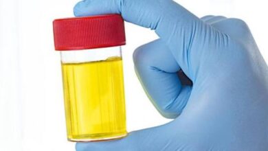 لماذا لون البول أصفر؟