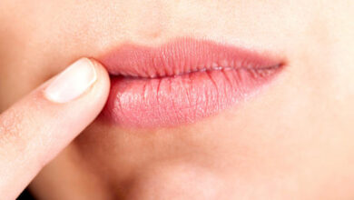 تشقق زوايا الفم قد ينجم عن أسباب خطيرة