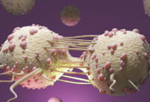 الصحة العالمية: الإصابات الجديدة بالسرطان سترتفع 77% بحلول 2050