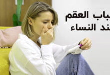 ماهي مؤشرات العقم عند النساء؟