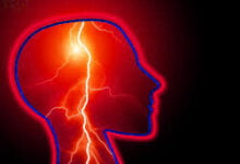 ‫الصرع الأعراض والعلاج‬