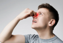 الأسباب الخطيرة لنزيف الأنف؟