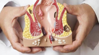 عوامل ترفع خطر تضخم البواسير