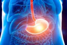 أعراض التهاب المريء؟