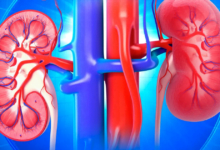 السكري وارتفاع ضغط الدم ‫يهددان بالفشل الكلوي