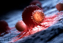 كشف سرطان القولون والمستقيم بفحص للدم