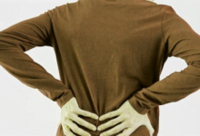 ‫تضيق القناة الشوكية الأسباب والأعراض