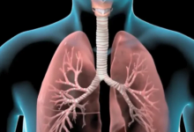 ‫التهاب الشعب الهوائية الحاد أعراضه ومخاطره