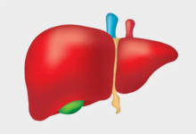 ماهي متلازمة بود شياري؟