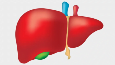 ماهي متلازمة بود شياري؟