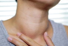 تغيير بحة الصوت قد يكون إشارة لسرطان الغدة الدرقية