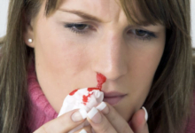 متلازمة "فون ويلبراند"؟