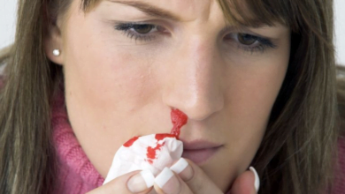 متلازمة "فون ويلبراند"؟