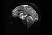 أدق صورة دماغ باستخدام أقوى أجهزة التصوير بالرنين المغناطيسي