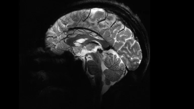 أدق صورة دماغ باستخدام أقوى أجهزة التصوير بالرنين المغناطيسي
