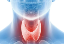 الغدد الصماء في الجسم