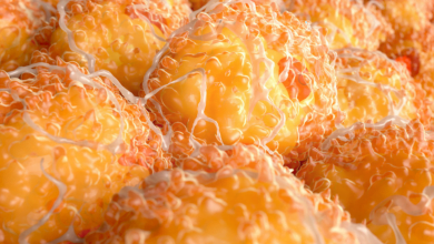 خلاياك الدهنية أكبيرة أم صغيرة؟