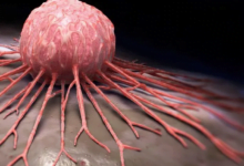 العلاج المناعي