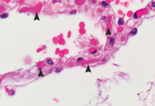 تطوير روبوتات هجينة بيولوجيا لعلاج السرطان