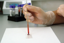 ثورة في التشخيص الطبي: قطرة دم واحدة تكشف عن حالة صحتك الشاملة في دقائق باستخدام الأشعة تحت الحمراء والتعلم الآلي