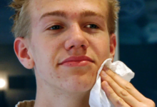 حَبّ الشباب :هل يمكن أن تقلل منه أحماض أوميغا 3 الدهنية؟