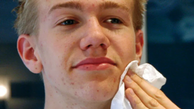 حَبّ الشباب :هل يمكن أن تقلل منه أحماض أوميغا 3 الدهنية؟