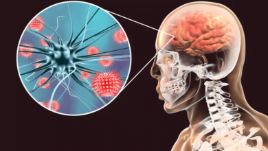 التهاب الدماغ بعد العدوى يُسبب ضعف العضلات