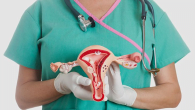 متلازمة تكيس المبيض: معاناة كبيرة لكثير من النساء