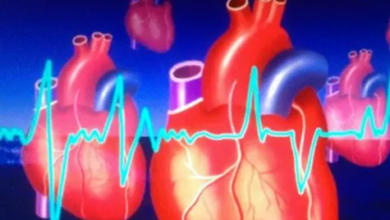 ابتكار طبي: الاستئصال بالمجال النبضي يحدث ثورة في علاج الرجفان الأذيني