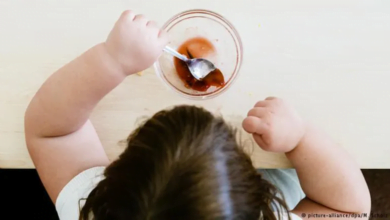 دراسة جديدة تكشف: السمنة في الطفولة تزيد من خطر الإصابة بالأمراض الجلدية المرتبطة بالجهاز المناعي