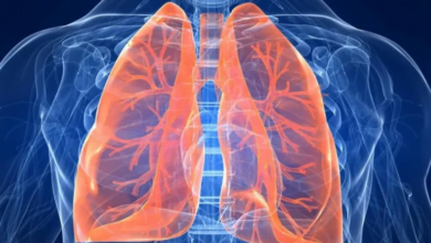 التدخين والتلوث: أسباب رئيسية لانتفاخ الرئة وتأثيراته على الصحة