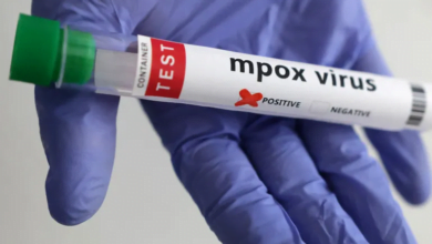 وزارة الصحة الأردنية تعلن تسجيل إصابة جديدة بجدري القرود لشخص مقيم في البلاد