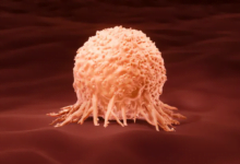 من المسؤول عن سقوط الجهاز المناعي أمام الخلايا السرطانية الغازية؟