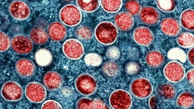 الهند تشتبه في إصابة جديدة بجدري القردة لرجل عائد من دولة تشهد تفشي الفيروس