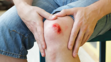 بروتين من ديدان طفيلية يعزز التئام الجروح ويمنع الندب: اكتشاف علمي جديد في جامعة روتجرز