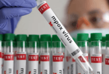 الكونغو الديمقراطية تطلق حملة تطعيم ضد جدري القردة وسط تحديات لوجستية