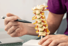 تطوير هلام مبتكر مستوحى من مخاط الأبقار لعلاج الانزلاق الغضروفي بعد الجراحة