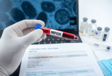 الهند تسجل أول إصابة بجدري القرود من السلالة الفرعية سريعة الانتشار