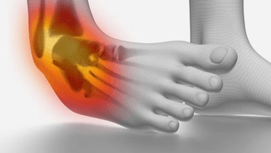 إصابات الكاحل: الأسباب، العلاج، وطرق الوقاية