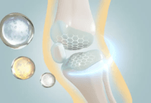 كل ما تحتاج معرفته عن سرطان العظام: الأنواع، الأعراض، والعلاج